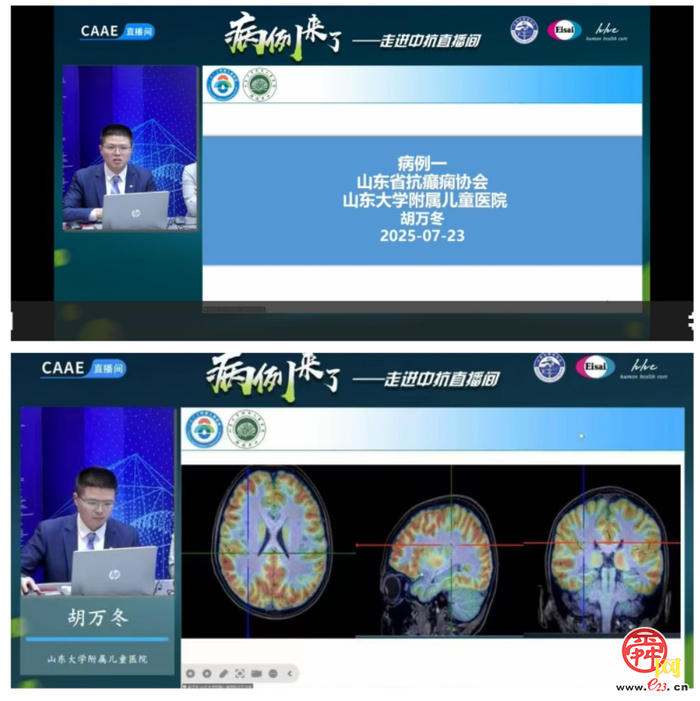 山东大学附属儿童医院团队再登国家学术平台——多学科协作破解疑难病例，直播观看量刷新纪录