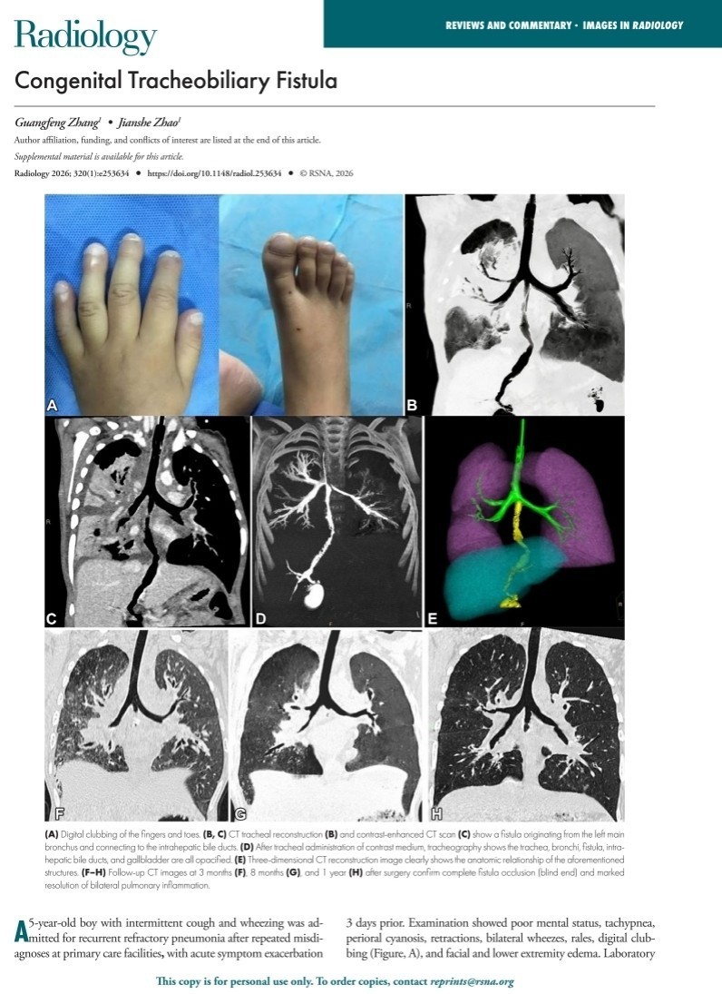 山东大学附属儿童医院医学影像科病例报道在国际放射顶刊《Radiology》发表