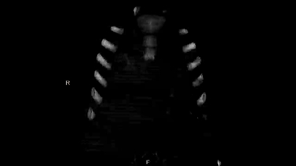 山东大学附属儿童医院医学影像科病例报道在国际放射顶刊《Radiology》发表