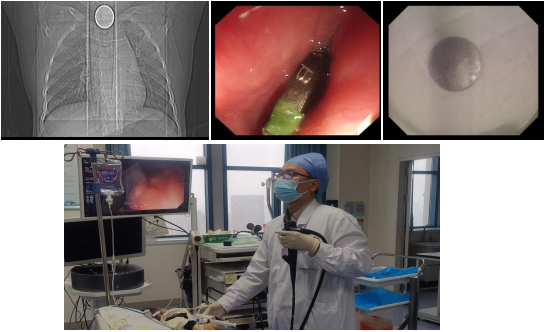 三岁娃咳嗽十天，元凶竟是“它”！