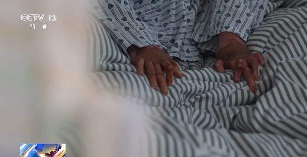 热搜第一! 央视曝光有学生吸食这个成瘾,18岁少年全身90%烧伤