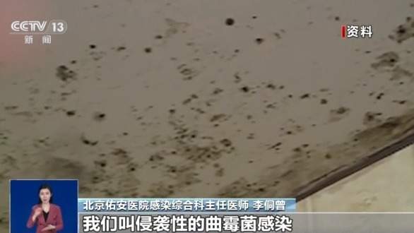 女孩脑部被真菌侵蚀出现“空洞”？大扫除要警惕霉变粉尘！