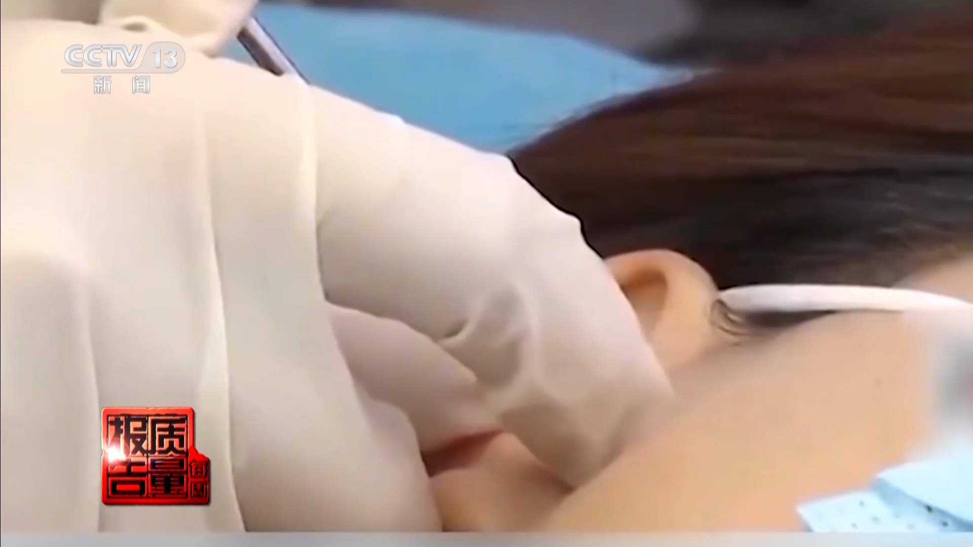 每周质量报告丨“麻药一过，生不如死” 揭秘“精灵耳”整形乱象