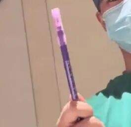 怕孩子被抱错，准爸爸用“猪肉记号笔”盖章，“20多天后会自然掉色”！新生儿能用吗？最新回应