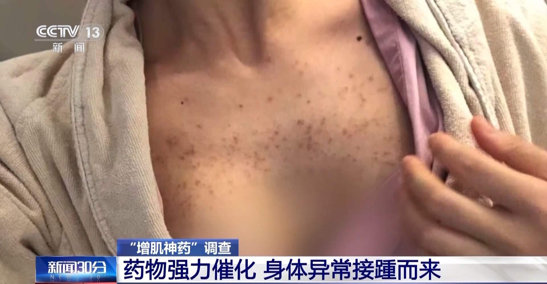 健身账号大肆兜售“增肌神药” 成分中竟包含兽药