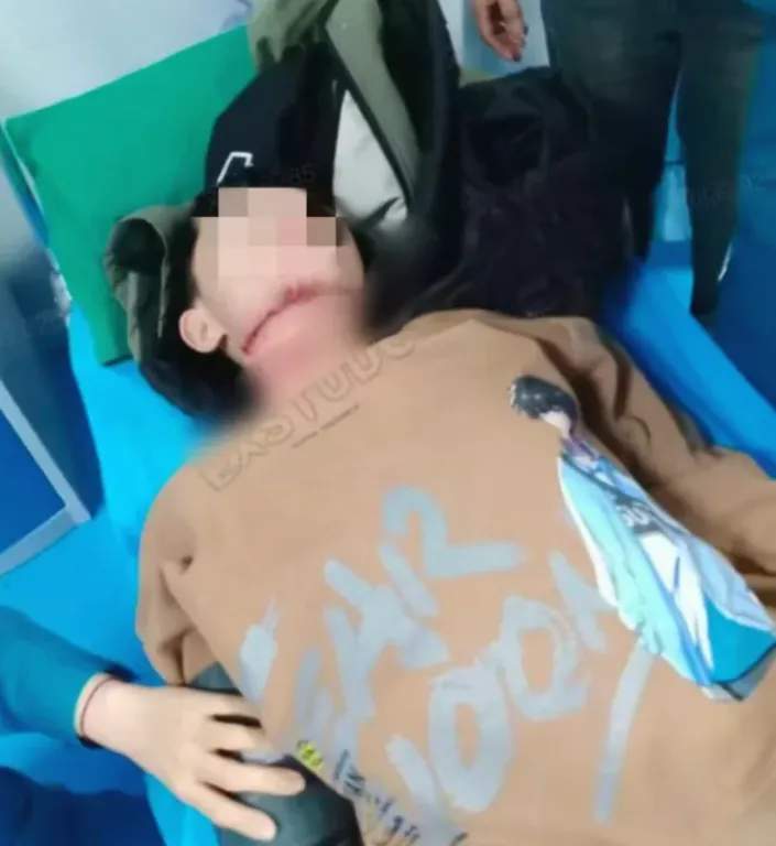13岁男孩骑车被绳子割喉，最新后续
