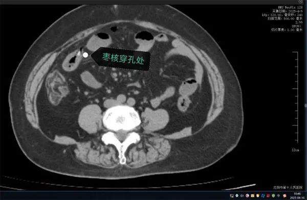 好吃却可能惹出大麻烦 警惕粽子里的“隐形刺客”