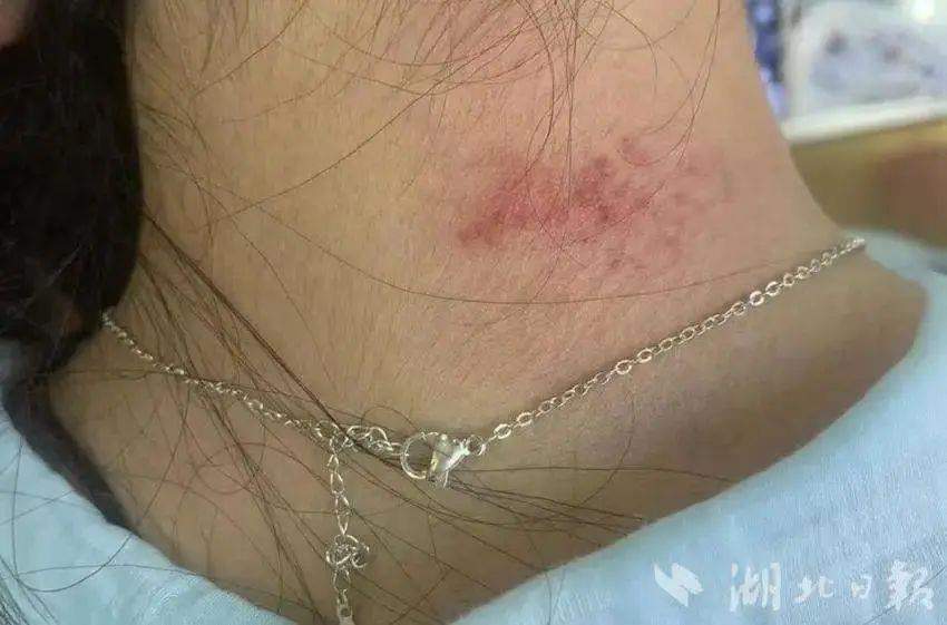“美丽首饰”高毒性重金属超标1179倍？有人已中招