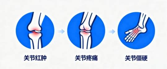 世界关节炎日|关节疼痛难忍?骨痛灵酊快速缓解,对抗关节炎症