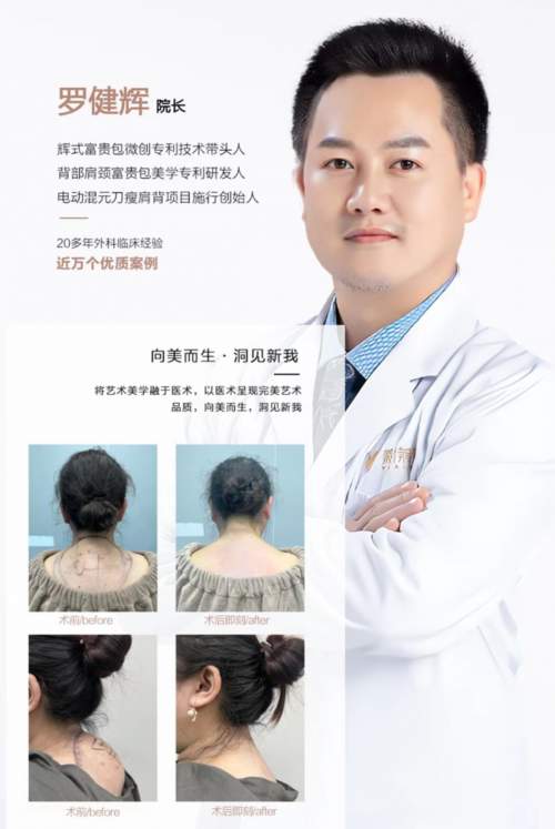 专注“背”后健康与美学，罗健辉：以“辉氏混元刀”微创技术重塑天鹅颈