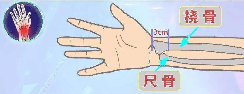 小伙摔倒以为没事7天后死亡 摔倒后这些信号千万别忽视→