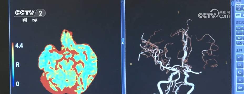 “AI+医疗”规模化应用“加速跑” AI健康管理迎来爆发期形成万亿级市场