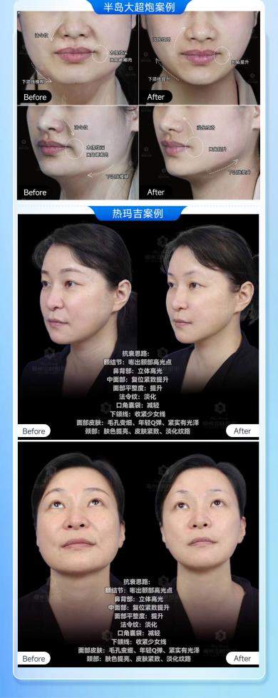 福州海峡高阶联合抗衰｜林智斌导师级热玛吉多维联合打法，告别单一项目瓶颈