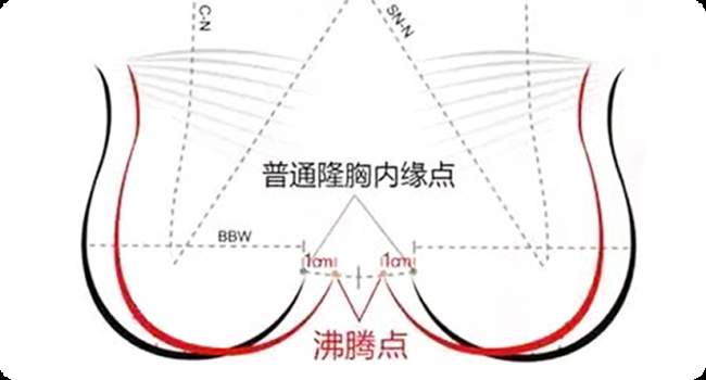 拯救受伤乳房｜福州海峡整形粉红丝带乳房援助行动启幕 最高可申领30000元公益援助