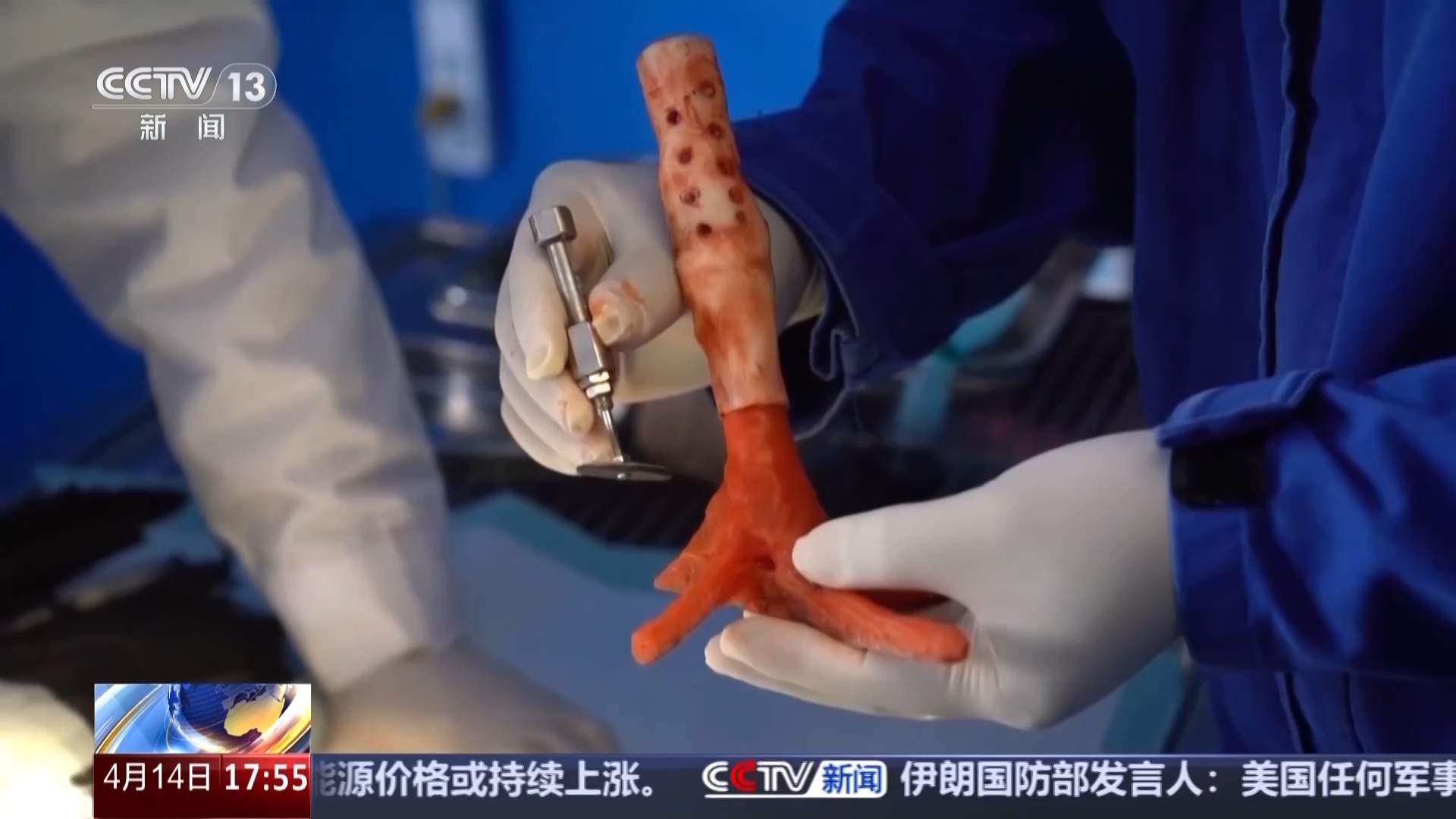 暖心救助！独脚东方白鹳成功装上 “机械腿”