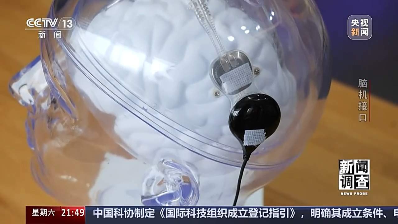 从科幻走向现实 脑机接口技术帮助患者“接”入未来