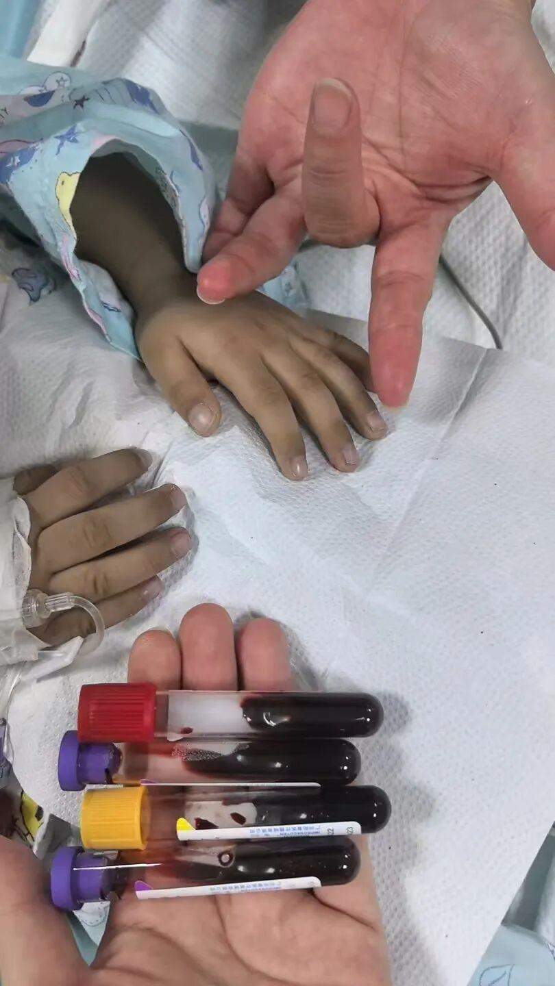 男童长期吃隔夜菜脸色发青 老师坚持送医救了一命……