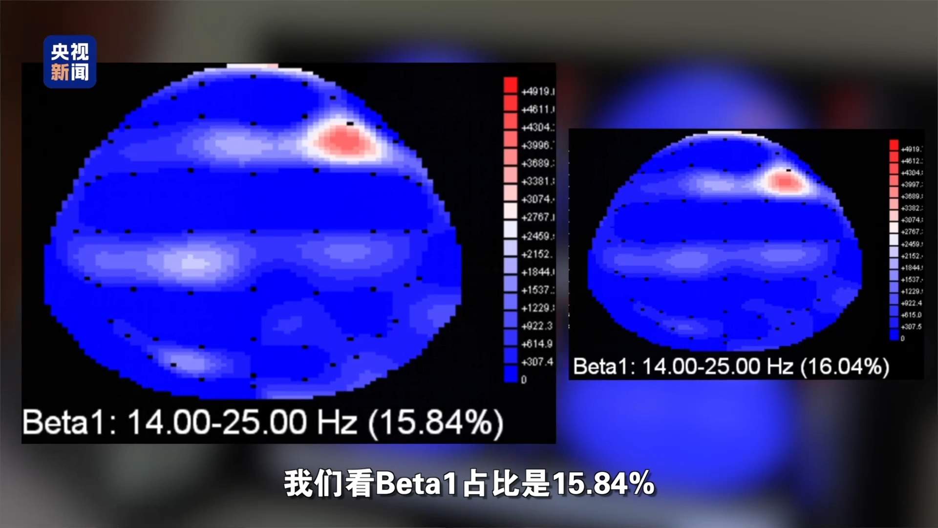 用AI做暑假作业 会改变孩子的大脑吗？
