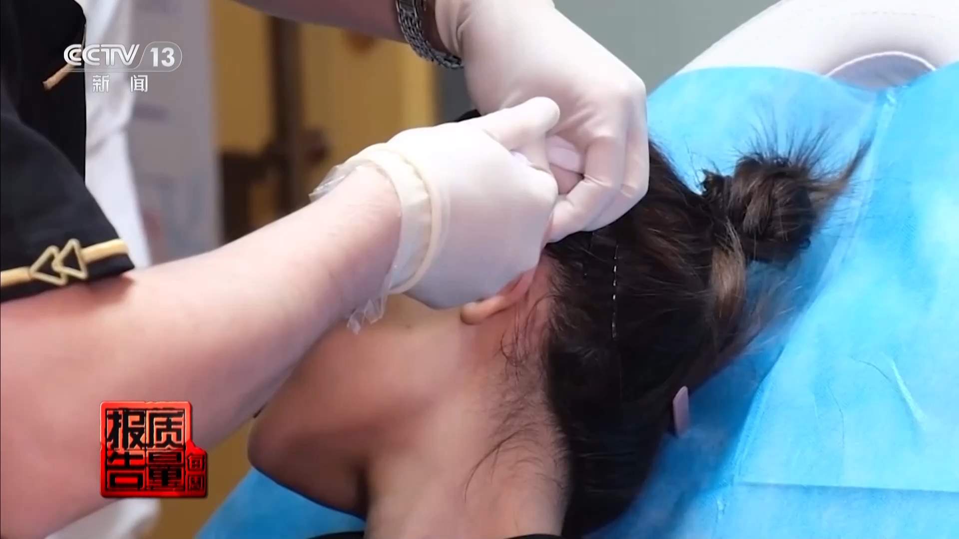 每周质量报告丨“麻药一过，生不如死” 揭秘“精灵耳”整形乱象