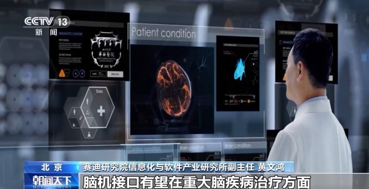 从科幻走向现实 今年我国脑机接口市场规模将突破38亿元