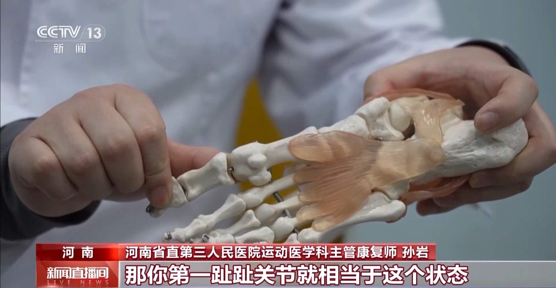 疯狂种草碳板跑鞋？医生：足底筋膜炎警告！