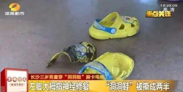 这种拖鞋穿着舒服，其实正在毁掉你的脚