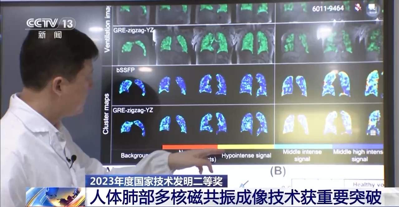 重要突破！“点亮”肺部为重疾早期筛查提供新路径