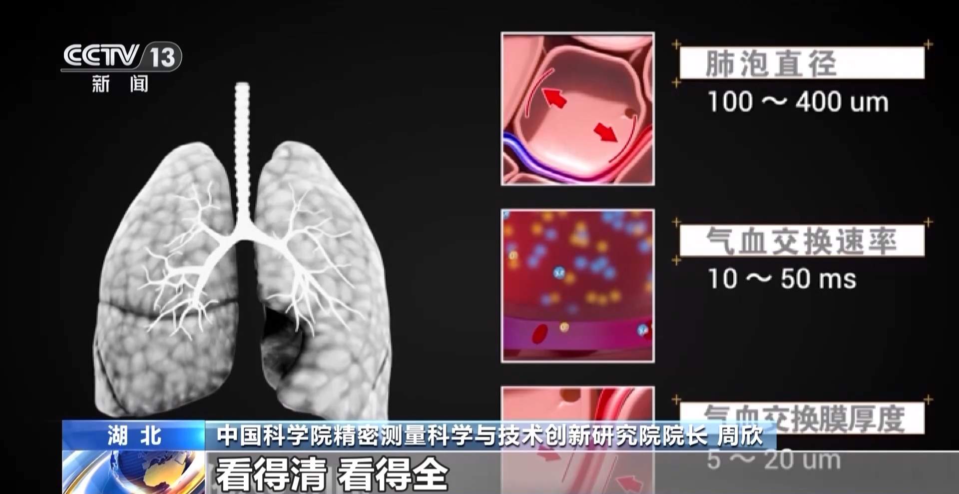 肺部磁共振技术取得新突破 采样时间提升到3.5秒