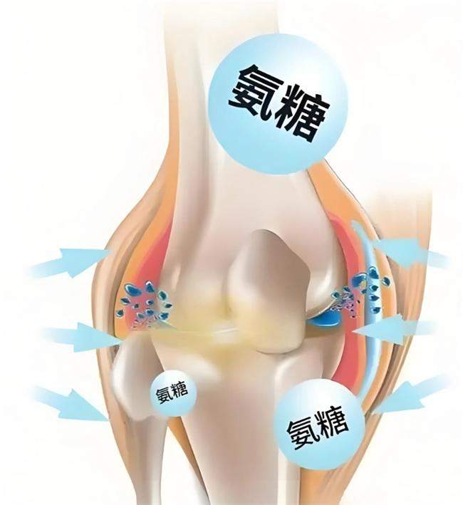 分清OTC硫酸氨糖与氨糖软骨素区别，九尽天寒关节养护不松懈