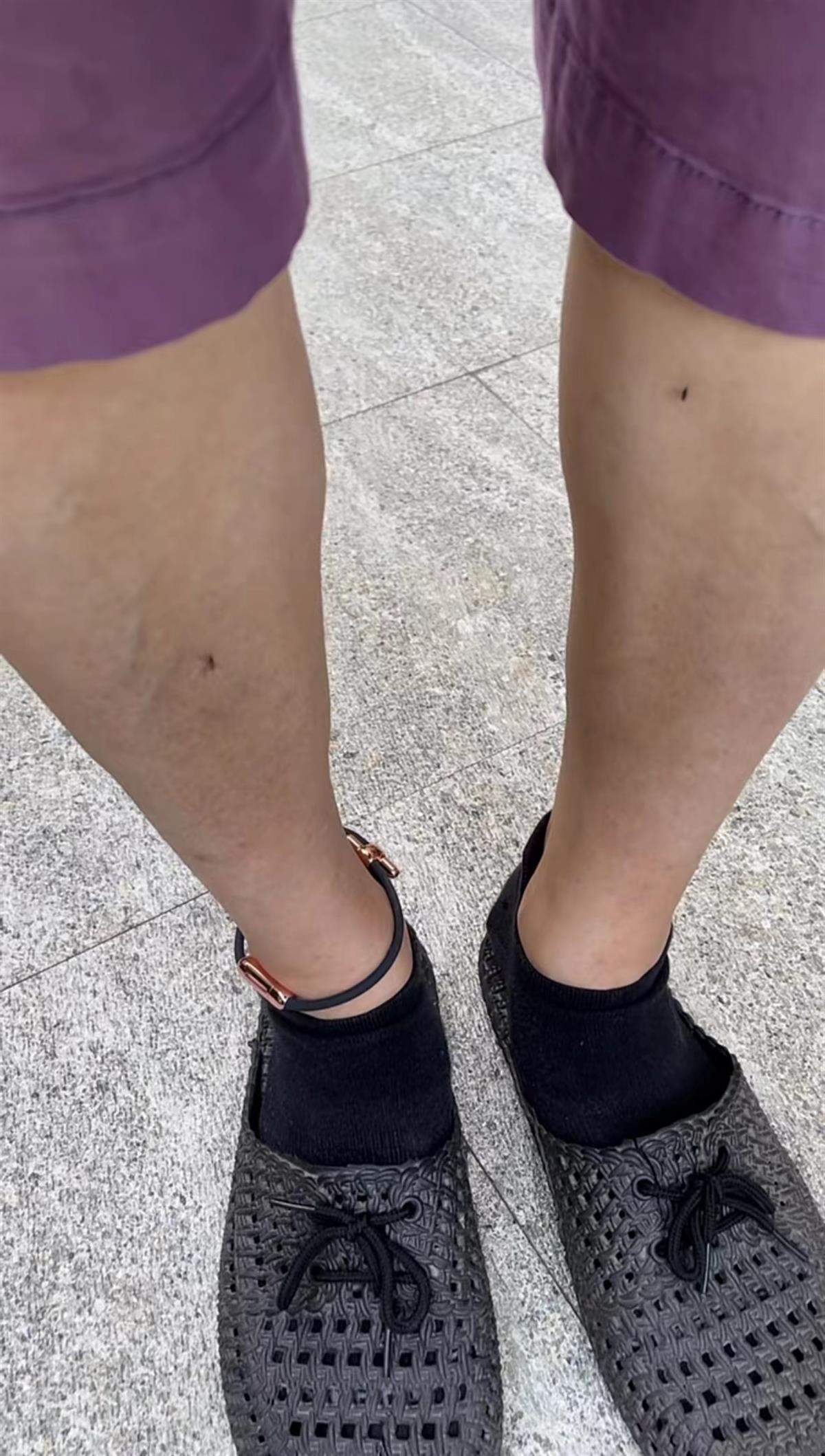 价格从几元到数百元，驱蚊手环效果惹争议，多款产品无资质