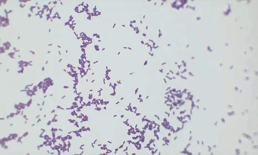 因吃剩菜不幸去世 这个隐匿的“冰箱杀手”别忽视！