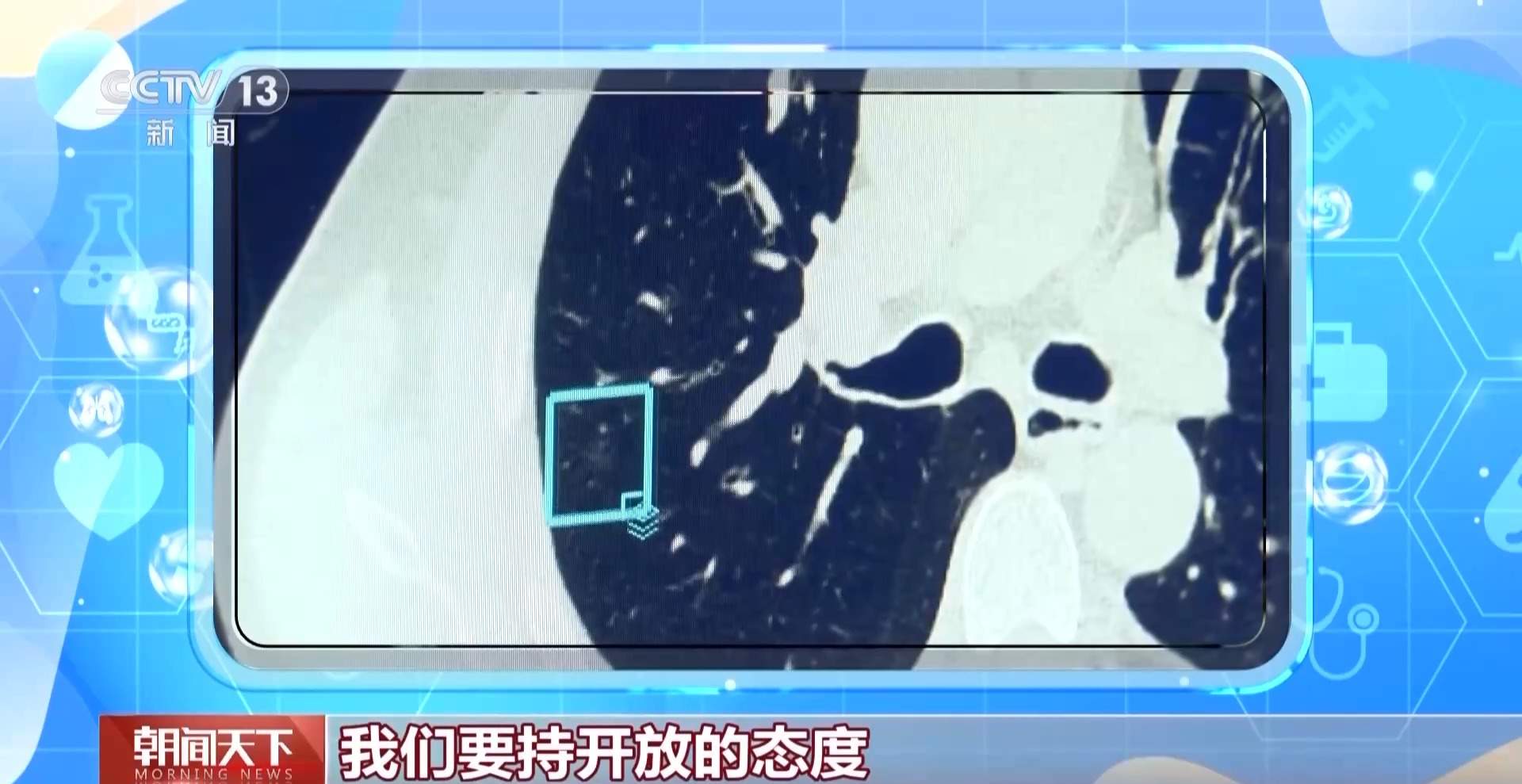 “AI医生”能取代医生吗？听听医药科技专家学者怎么说