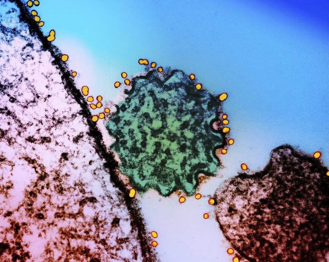 人传人、致死率高！印度尼帕病毒疫情，会波及我国吗？