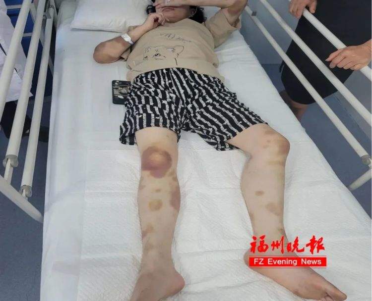 21岁女子睡觉时拳打脚踢,醒来什么都不记得!医生:不是梦游