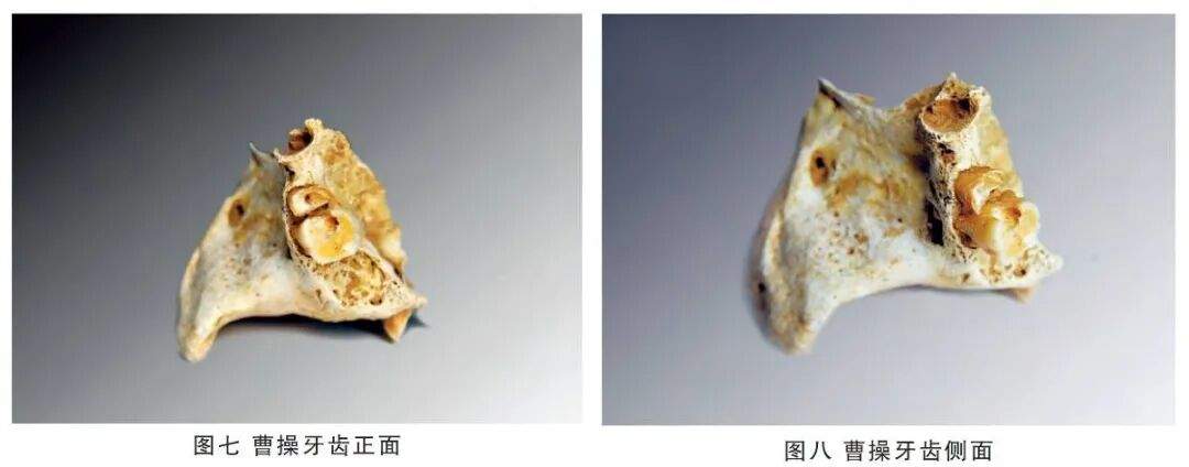 曹操墓前摆布洛芬，暴露危险“误区”！