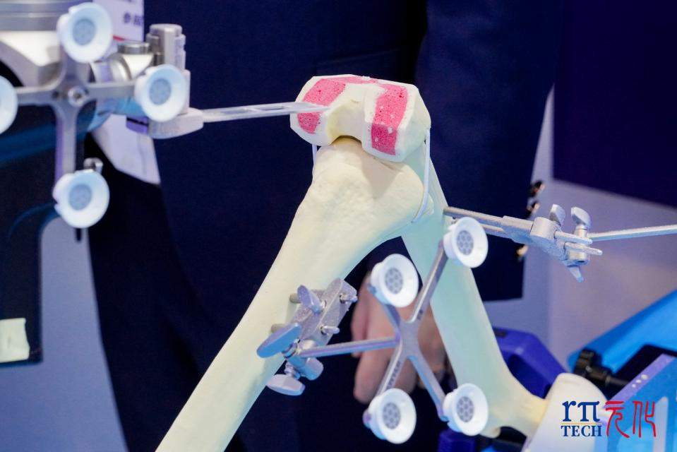 深企元化智能携全国首个全自研骨科手术机械臂亮相COA2025