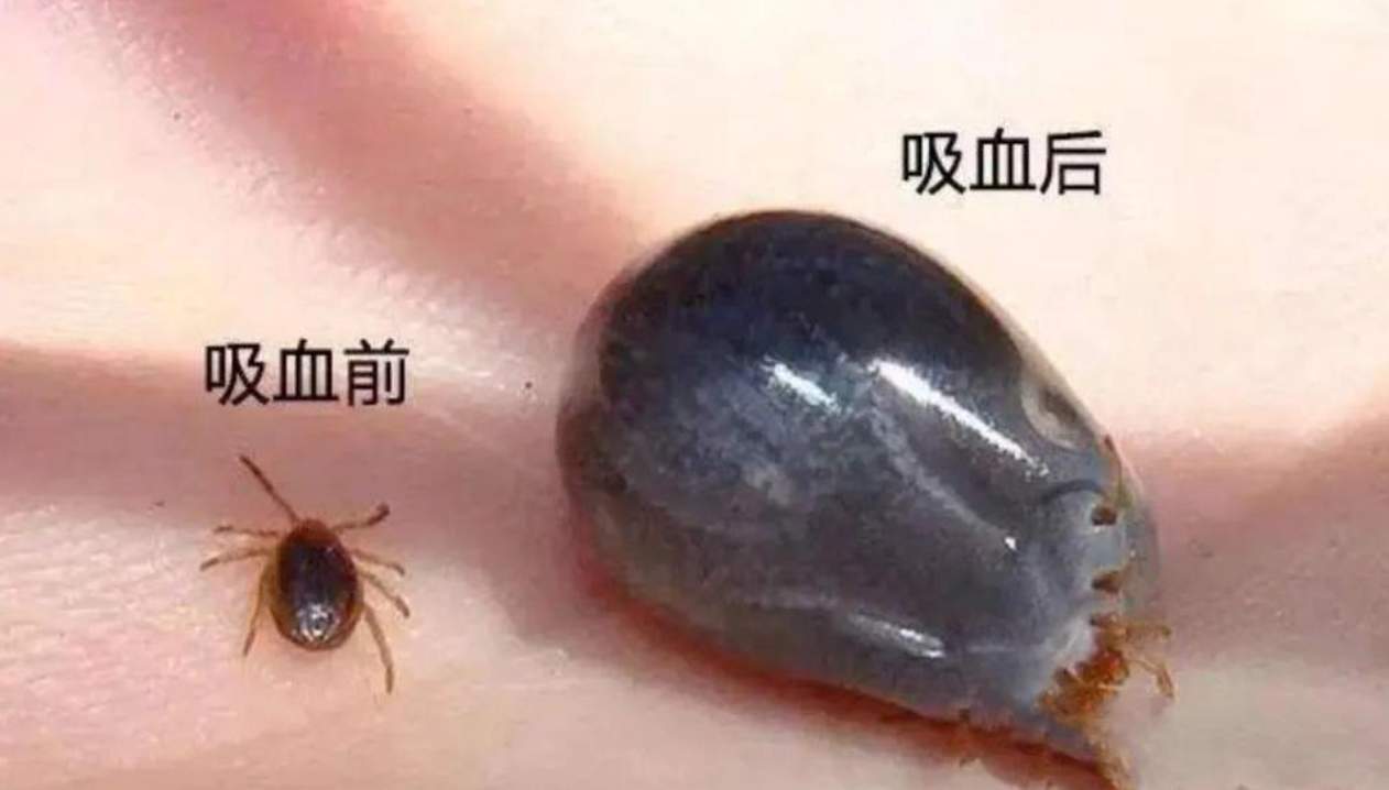出游警惕这种小虫子 由它引发的疾病已达20余种