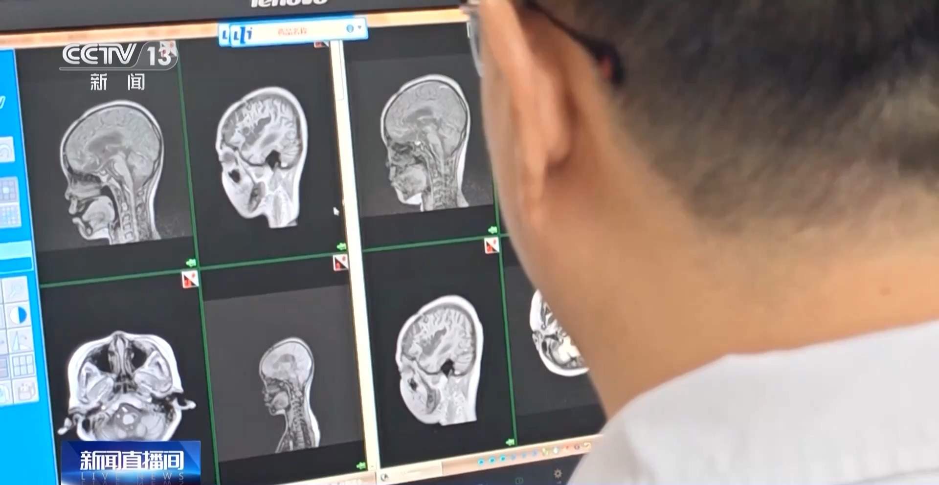 献血量2892万单位 去年我国献血人次和献血量均创历史新高