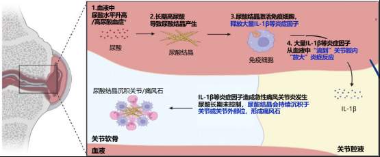 痛风发作吃别嘌醇管用吗?揭秘抗炎药和降尿酸药的分工