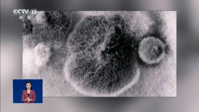 女孩脑部被真菌侵蚀出现“空洞”？大扫除要警惕霉变粉尘！