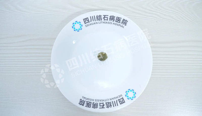 一束鲜花表谢意，一份信赖寄四川结石病医院！八年结石，患者隐痕保胆终遂心 - 商业 - 科智网 