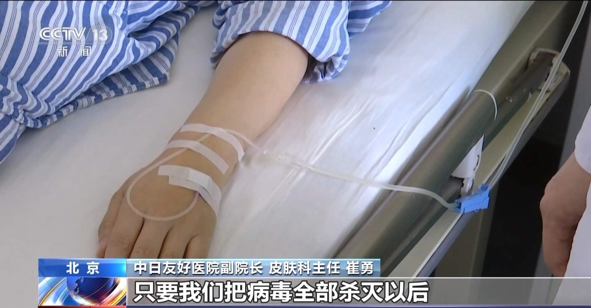 50岁以上为带状疱疹易发人群 出现这些症状需警惕