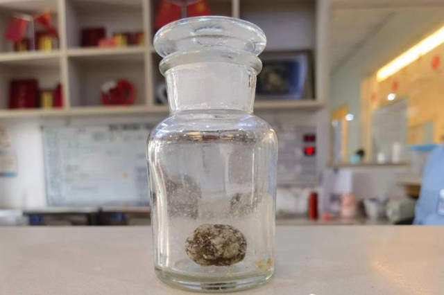 黔南小伙“无痕”心愿成真：贵阳结石病医院医生妙手保胆不留痕