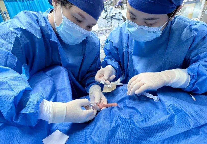 妈妈怀孕5个多月产下巴掌大宝宝，330克、肠道如发丝，105天后平安出院