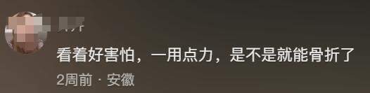 骨瘦如柴!女子身高1米6体重50斤仍减肥 自称只是喜欢骨感身材