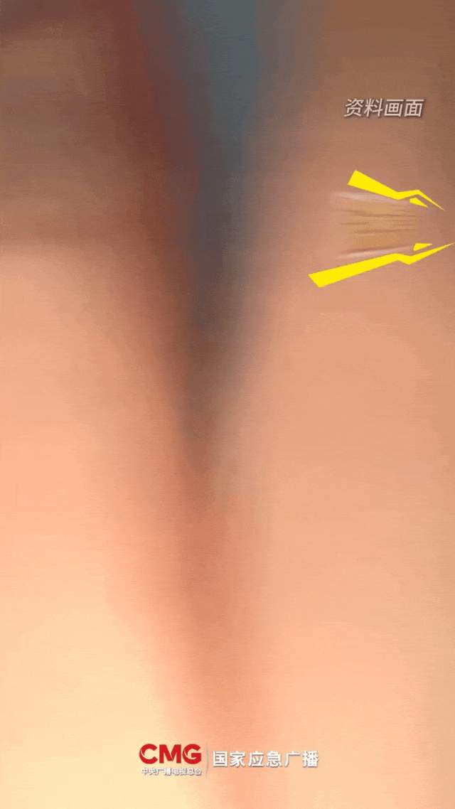 8岁娃持续呕出活虫,医生揪出元凶!可能你家也有