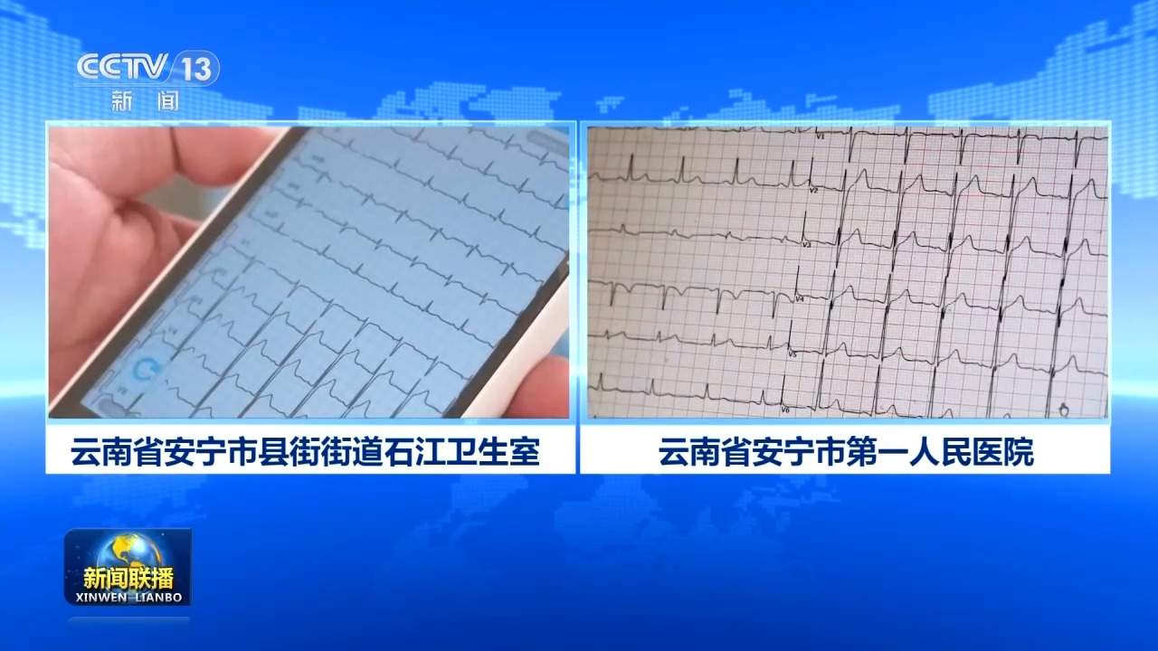 新思想引领新征程丨优质医疗资源下沉惠民 绘就健康中国新图景