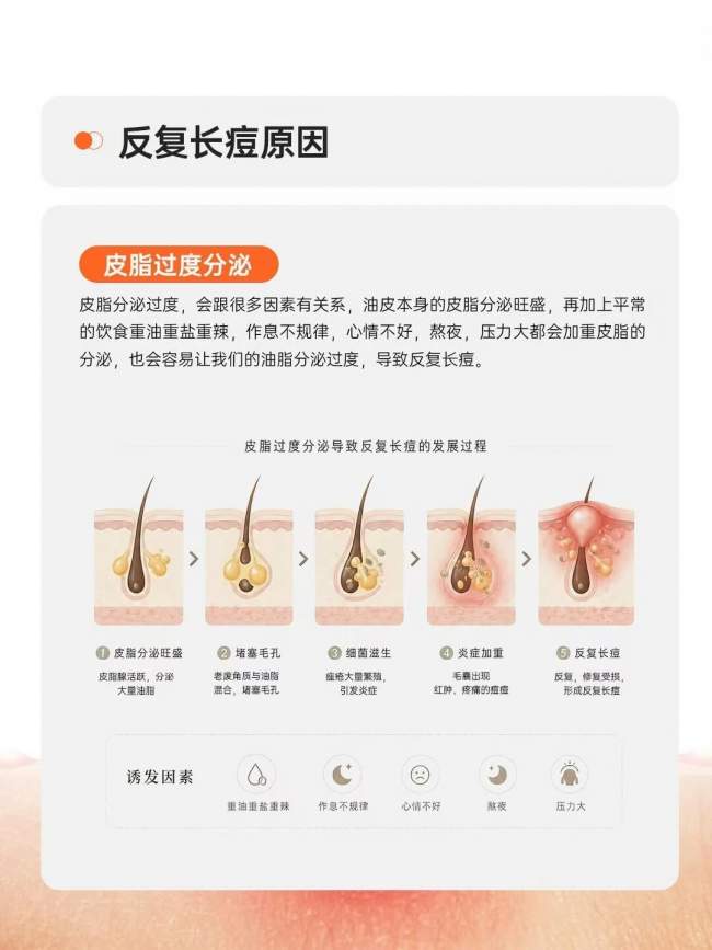 祛痘别只消表面炎症！海峡张光泽研创痘全净：分型分阶，先治痘再重建皮肤屏障