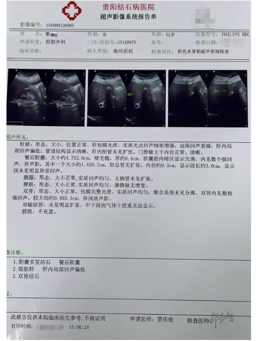 破解腹腔粘连困局，贵阳结石病医院完成高难度保胆取石
