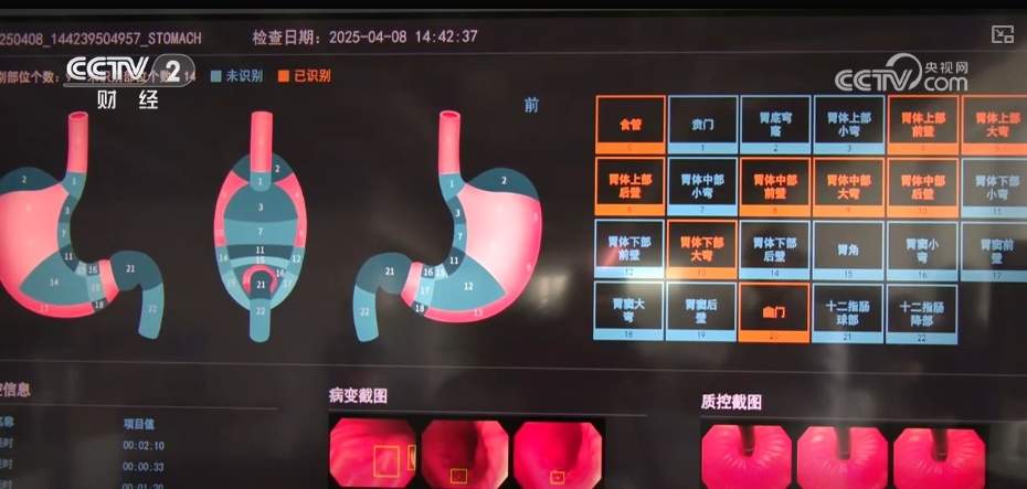 “AI+医疗”规模化应用“加速跑” AI健康管理迎来爆发期形成万亿级市场